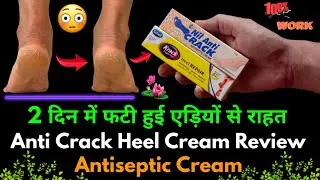 Krack heel repair cream review | Nil anti crack cream | Krack heel cream @RMedicineInfo
