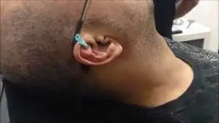 Piercing Rook - NickPiercing