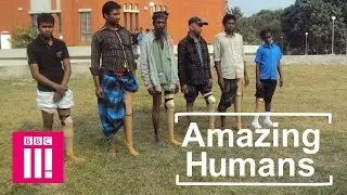 The British Doctors Who Turn Drainpipes Into Prosthetic Limbs