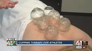 Cupping therapy for athletes