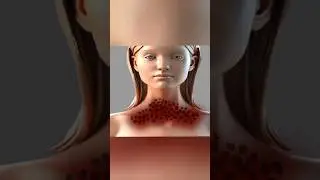 ASMR SKIN DEEP CLEANING #asmr #satisfyingasmr #animation