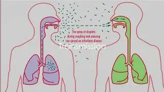 Part 17 : Public Health Diseases-Chain of Infection