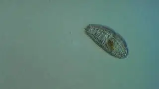 Ciliate: Coleps sp.