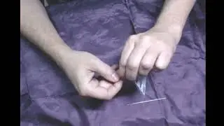 Acupuncture points for wrist pain and arthritis