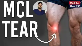 MCL Tear | Knee Ligament | MCL Tear and Repair | Dr.Sai Chandra @MedPlusONETV