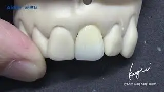 Biomic Stain kit-One Step Stain Instruction flowable ceramics