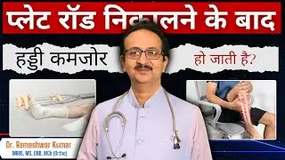 क्या प्लेट या रॉड निकालने के बाद हड्डी कमजोर हो जाती है? | Does Removing Plate or Rod Weaken Bone?