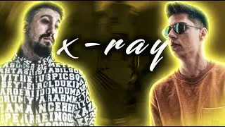 Rota x-ray (Berk