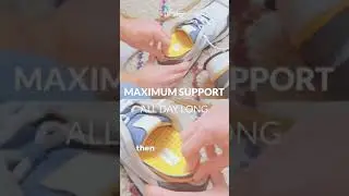 Orthotics Debunked The Shocking Truth About Foot Support Systems