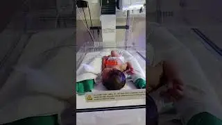 #nicu #nurses #doctor #subscribe #like #share