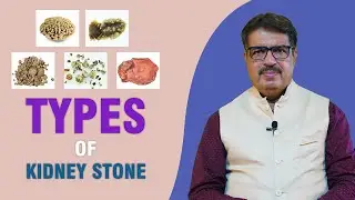TYPES OF KIDNEY STONES | EXPLAINED BY DR. KEDARNATH A. LONGANI M.D (HOM) | LONGANI CLINICS