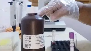 تحليل الهيموجلوبين عملي مانيوال