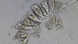 Glockentiere (Zoothamnium sp. - ca  150x)