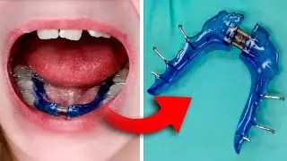 How a Lower Expander Works... How to Put it in and Activate
