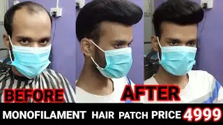Monofilament Hair Patch in Delhi | Hair Wig Price in India | Hair Wig Boy | Call Now - 9811000371