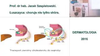 Łuszczyca: choruje nie tylko skóra