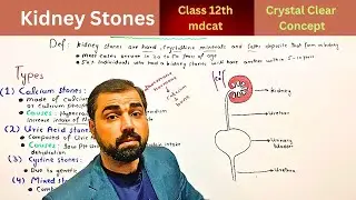 Kidney Stones Class 10th | Class 12 | Types and causes of kidney stones @GoldenEraScience
