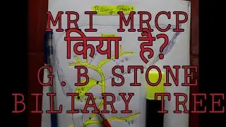 MRI MRCP, Gallbladder Stone, Biliary tree || Radiographer Guruji.