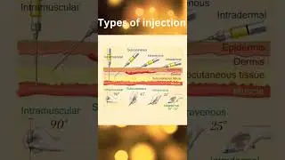 Types of Injections #intramuscularinjection #subcutaneous #intradermal #intravenous #aiapgetmcq