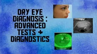 Diagnosis of dry eye - Insights into newer diagnostic tools