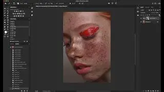 Как проявить веснушки на коже