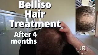 Biotin Shampoo and Conditioner Set for Hair Growth Belliso