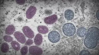 Why are certain diseases reemerging?