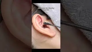 Ear Cleaning With Black Cotton Swab Is Very Satisfying! #asmr #earcleaning