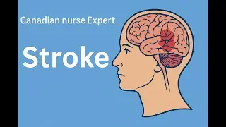 Stroke Emergency      #FAST #stroke #nclex