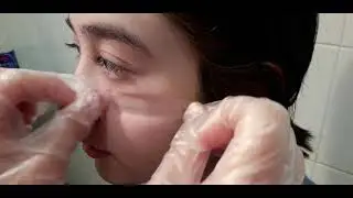 VIRTUALAB 2019: Determination of optimal cut off value of the adhesive tape method for demodicosis d
