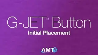 G-JET&reg; Initial Placement