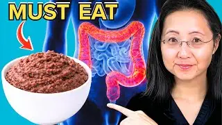 Colon Cancer: Top 10 Foods You Must Eat!