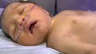 Newborn Baby with MSL, RDS & ENNs 🍼 NICU Treatment & Care Explained