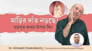 মাড়ির নড়বড়ে দাঁত মজবুত করার উপায় কি | How to fix loose teeth   Dr  Himadri Chakrabarty