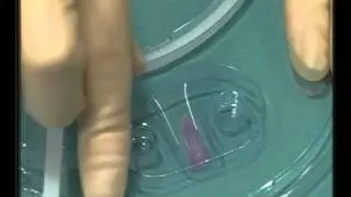 v3 xact stent