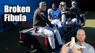 Calvin Ridley Injury Explained!  Calvin Ridley Fibula Fracture