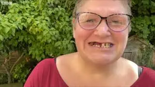 Woman forced to perform DIY dentistry