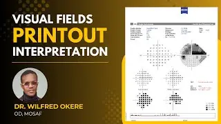 Visual Field Printout Interpretation | Full Tutorial on CVF Analysis