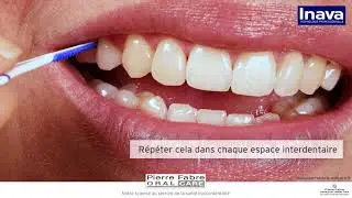 Comment utiliser l'Inava Dental Picks ?