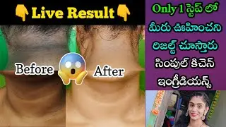 Only 1 స్టెప్ లో మీరు ఊహించని రిజల్ట్ చూస్తారు | How To Get Rid Of Dark Neck Fast😍 In Telugu | geeta