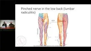 'Bulging discs' Causes, Symptoms, and Treatment Options