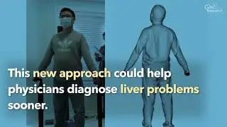 Bariatric Research using Fit3D for GWU: 3D Optical Scans & Machine Learning