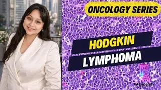 HODGKIN LYMPHOMA | BY DR. ADITI KUMAR