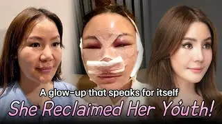 From Consultation to Recovery: A Real Plastic Surgery Experience at Nana Hospital