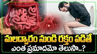 మలంలో రక్తం &ndash; ప్రమాదాలు, జాగ్రత్తలు || Blood In Stool &ndash; Risks And Precautions || Sanjeevini TV