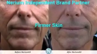 Nerium Better Than Botox Get Get Nerium San Antonio  | 210-305-7833