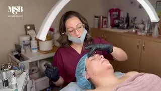 Microneedling with MYSKINBUDDY + Bee Bright | Christina Benavides, MSN, FNP-BC, LE