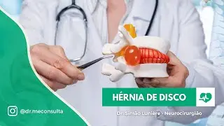 Hérnia de disco: Tratamento