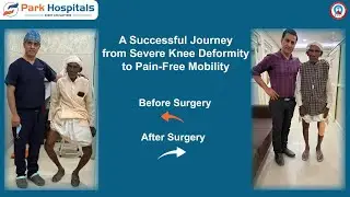 From Severe Knee Deformity to Pain-Free Walking | Life-Changing Surgery at Park Hospitals