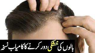 Balon Ki Khushki (Hair Dandruff) Ka Ilaj | Tibe Ahlebait (Part 39) | Maulana Syed Ali Naqi Kazmi